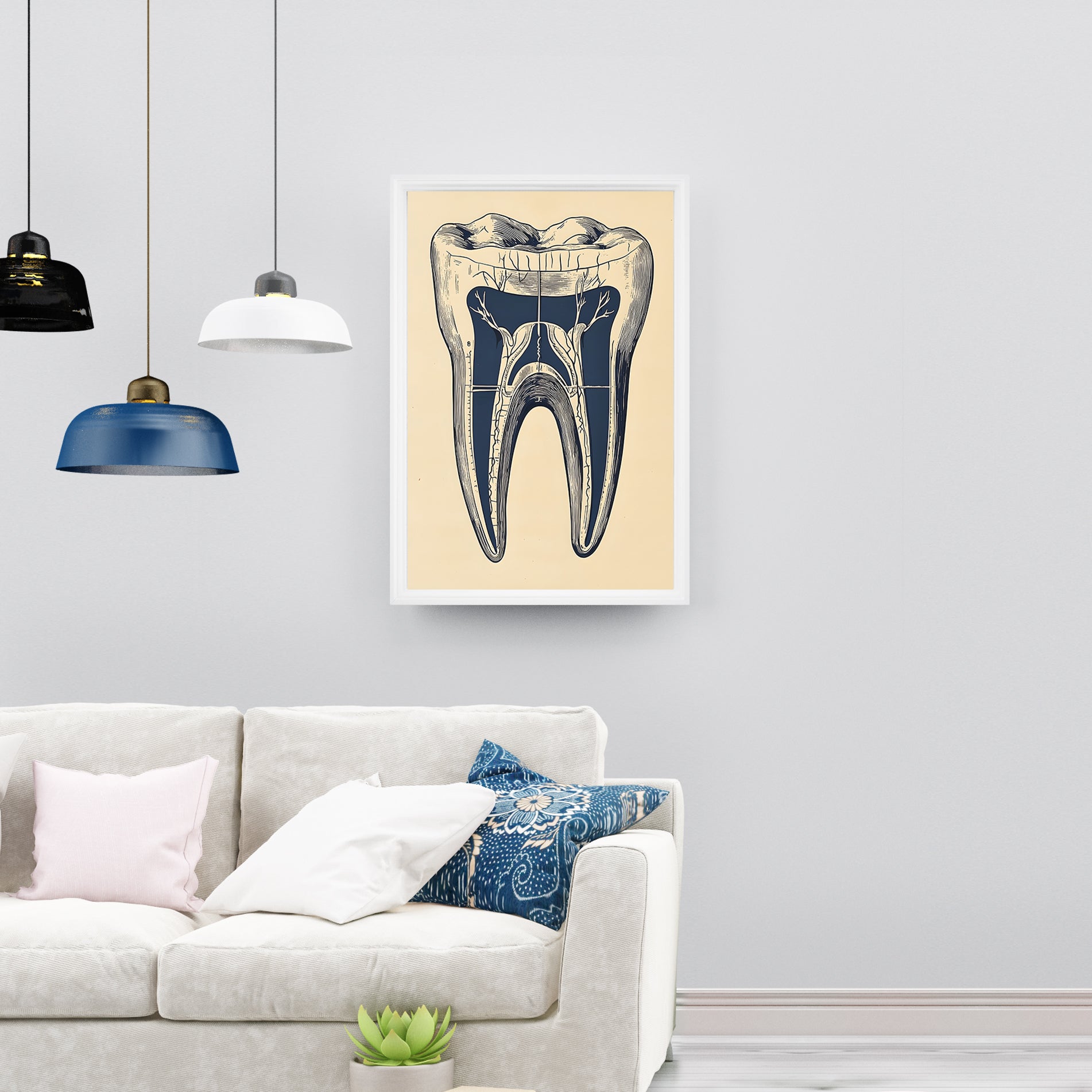 Tooth Anatomy Poster