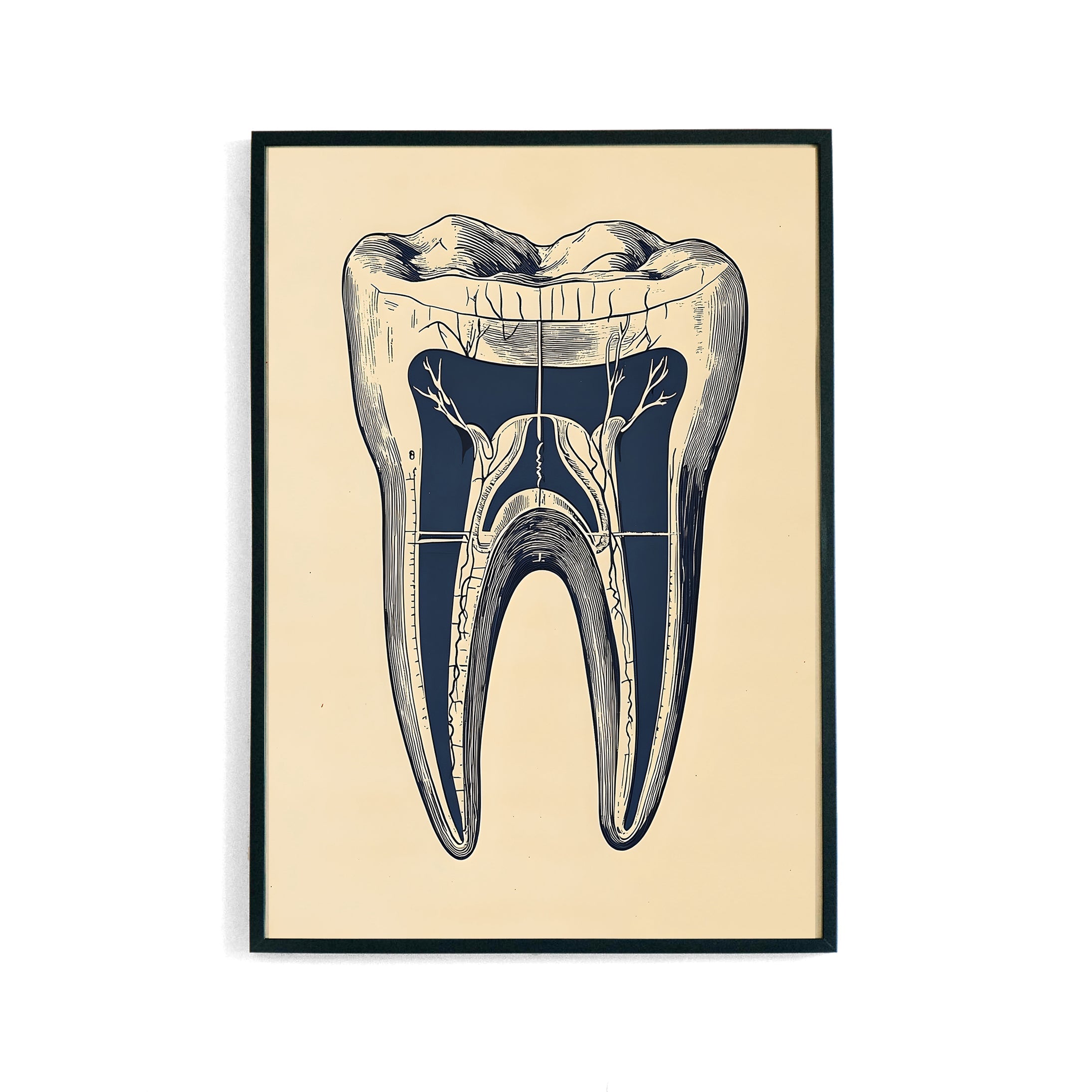 Tooth Anatomy Poster